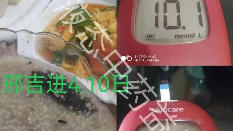小标题：维生素B6治脱发的注意事项